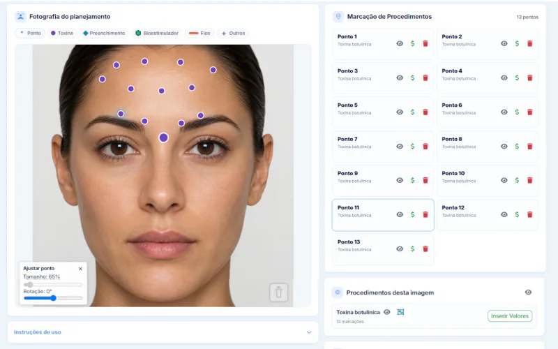 Harmonização orofacial: mapa facial e comparação de antes e depois